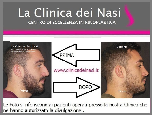 La migliore codificazione da alcolismo
