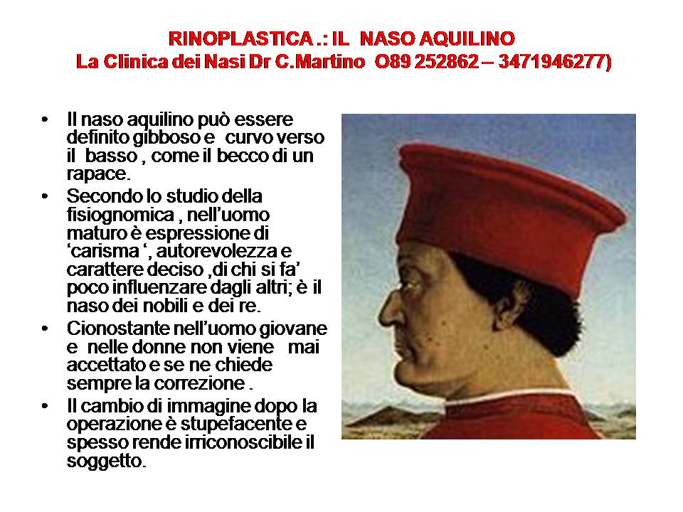 IL NASO AQUILINO
