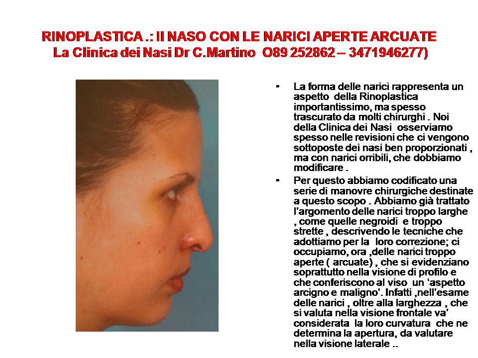 IL NASO CON LE NARICI APERTE