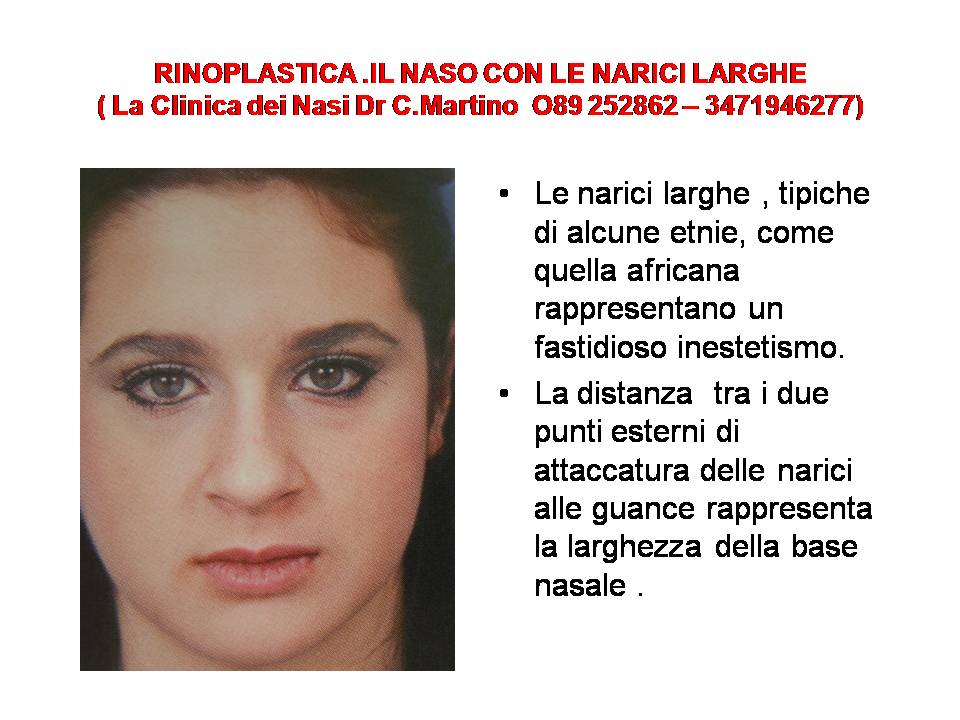 IL NASO CON LE NARICI LARGHE