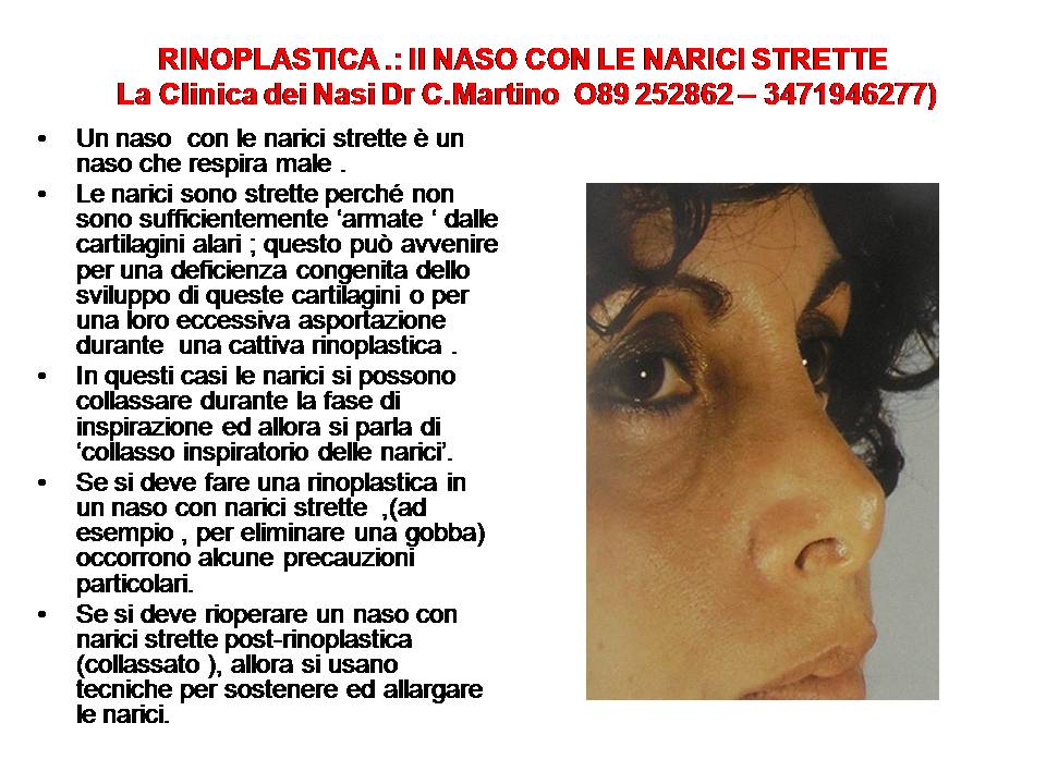 IL NASO CON LE NARICI STRETTE