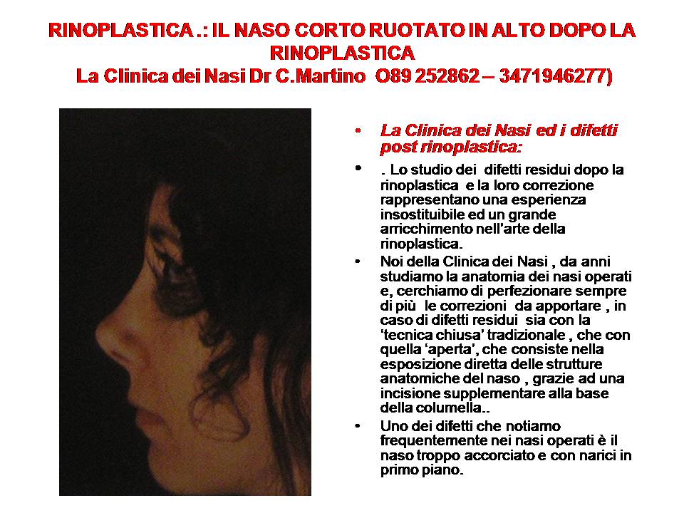 IL NASO CORTO RUOTATO IN ALTO