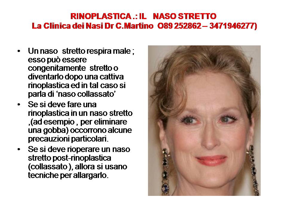 IL NASO STRETTO