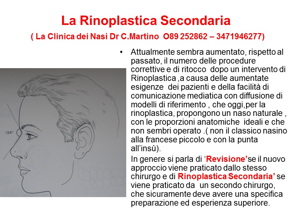 RINO SECONDARIA